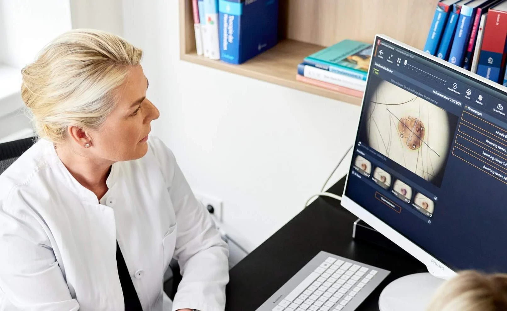 Dr. med. Daniela Wiebels beurteilt ein Muttermal am Bildschirm der digitalen Auflichtmikroskopie