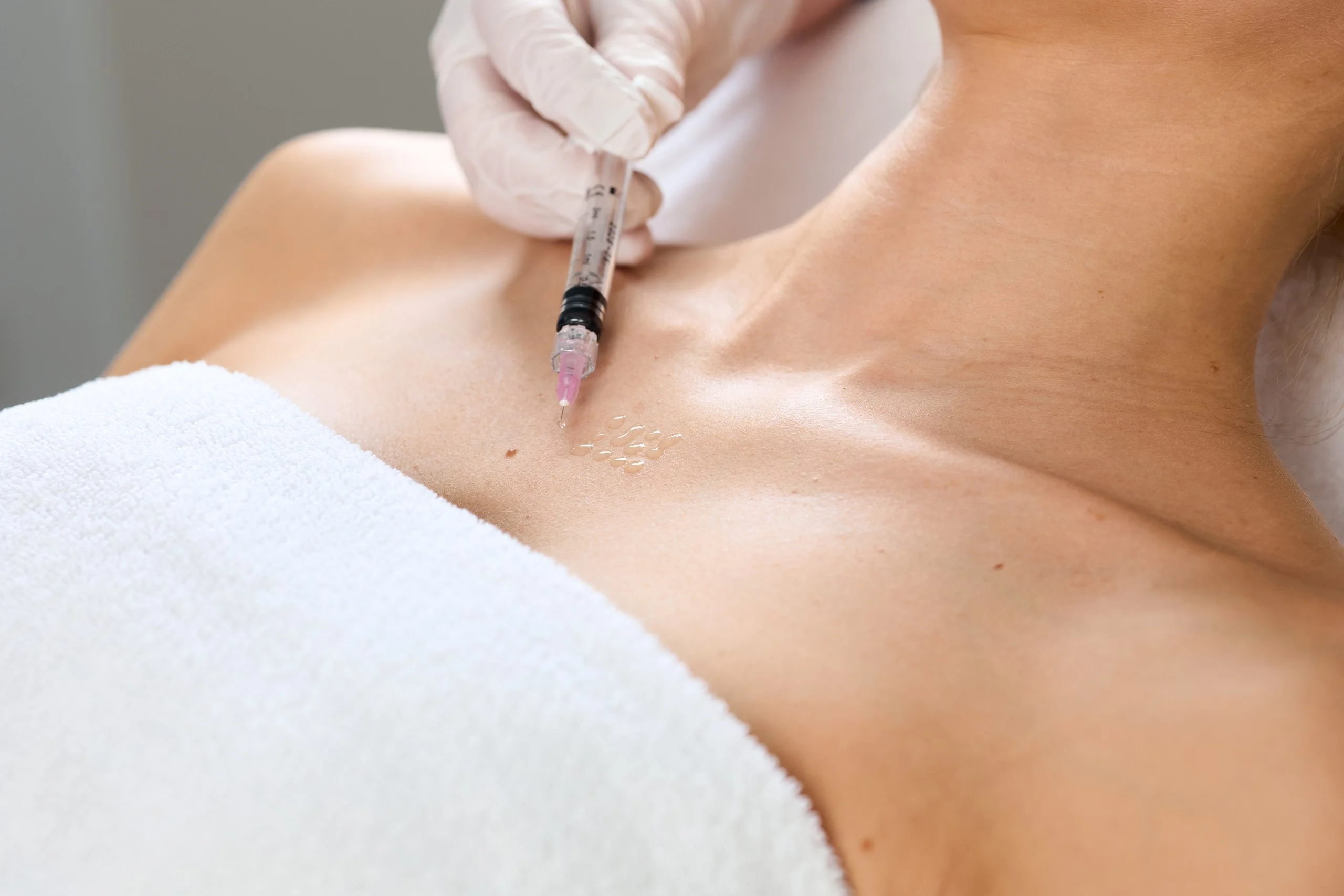 Ärztin der Hamburg Dermatologie setzt eine Injektion im Dekolleté-Bereich