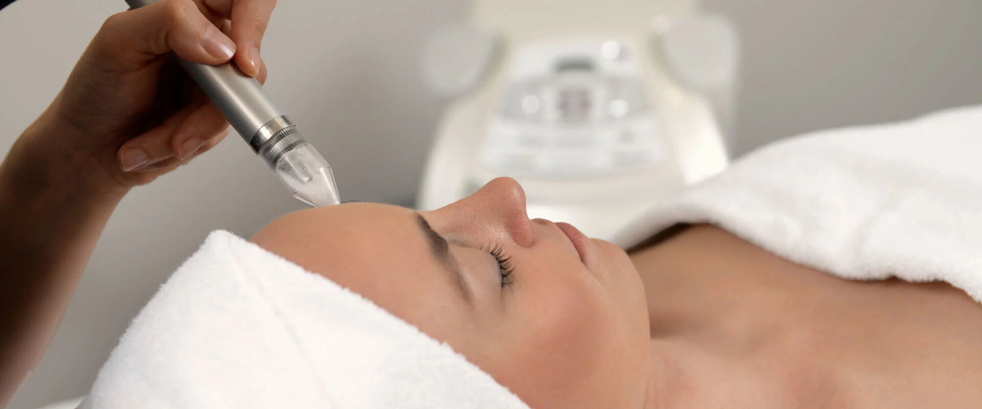 Microdermabrasion im Gesicht