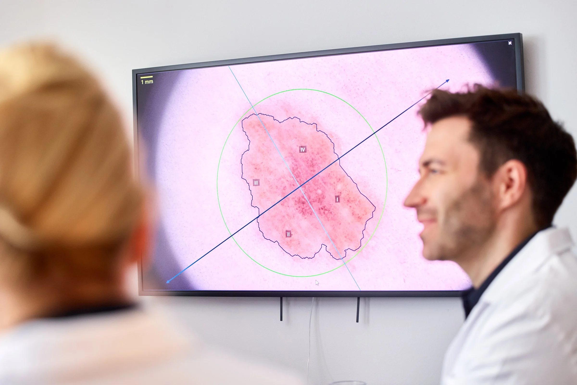 Arzt der Hamburg Dermatologie vor einem vergrößerten Hautbild auf dem Monitor