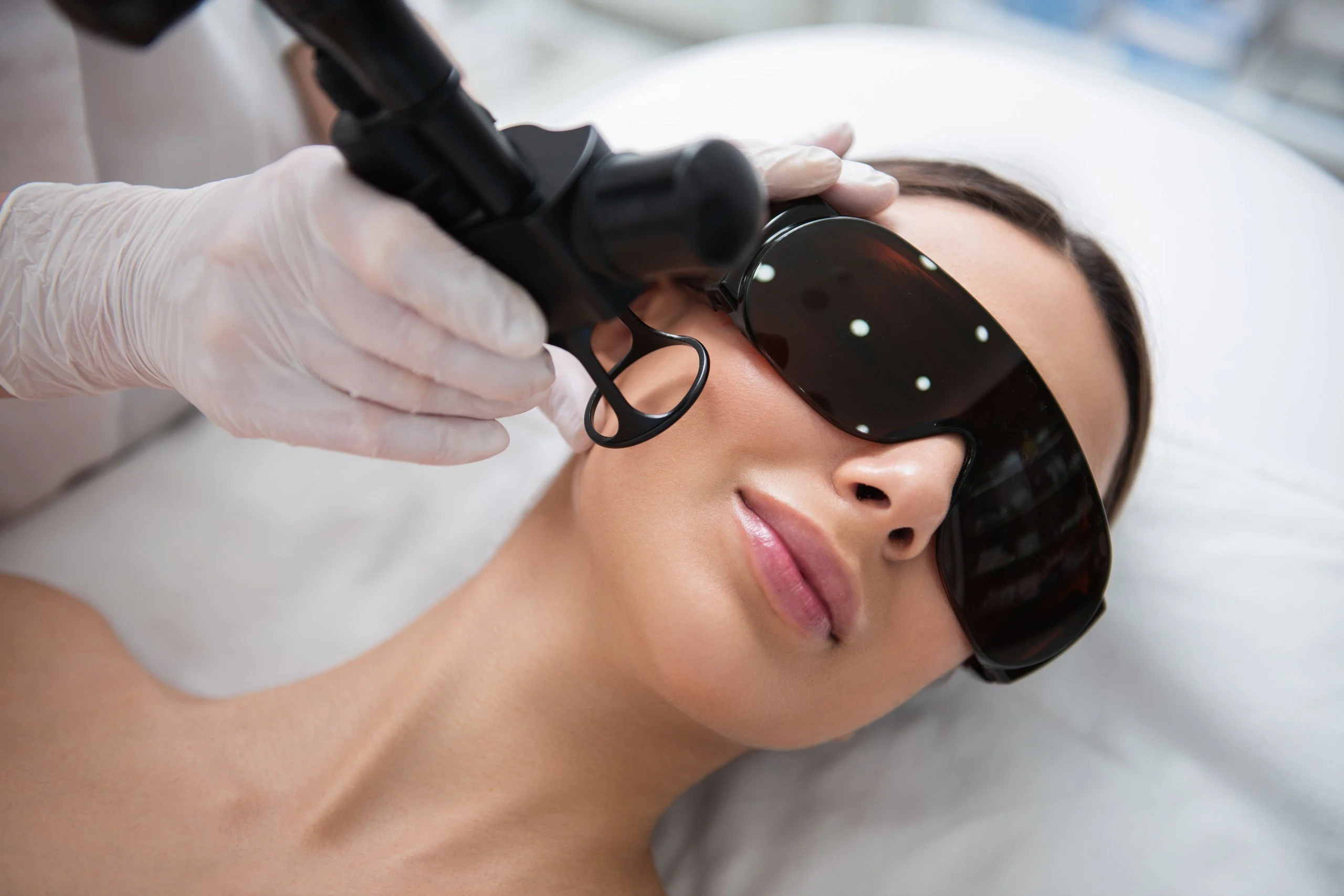 Laserbehandlung im Gesicht, die Patientin trägt eine Schutzbrille