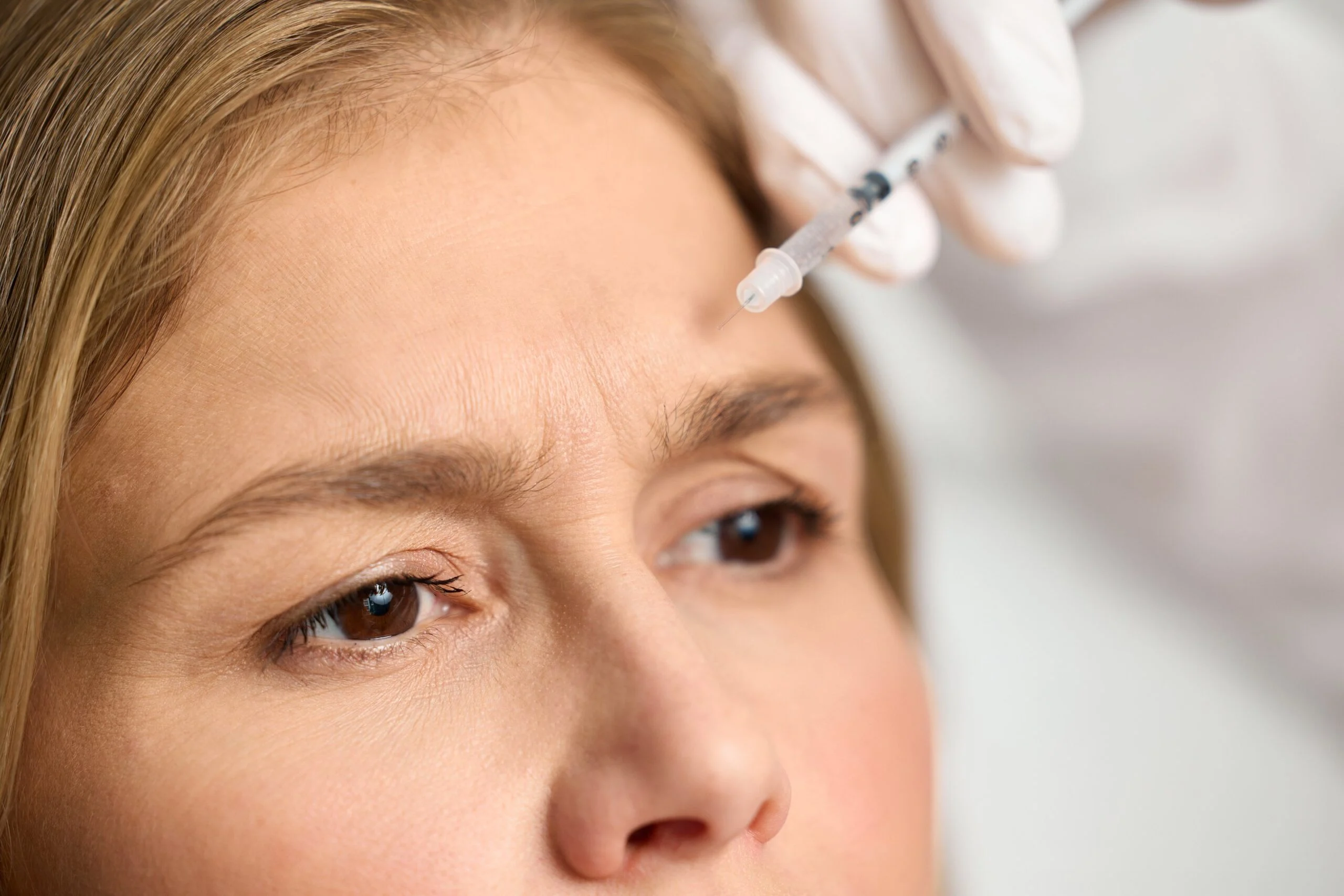 Injektion in die Stirn einer Patientin, Nahaufnahme